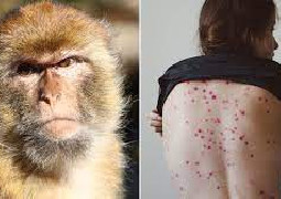 Confirmaron el primer caso de viruela del mono en Mendoza y es el cuar...